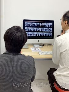 撮影した画像のチェック